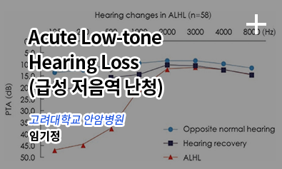 Acute Low-tone Hearing Loss / 고려대학교 안암병원 - 임기정
