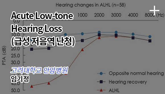 Acute Low-tone Hearing Loss / 고려대학교 안암병원 - 임기정