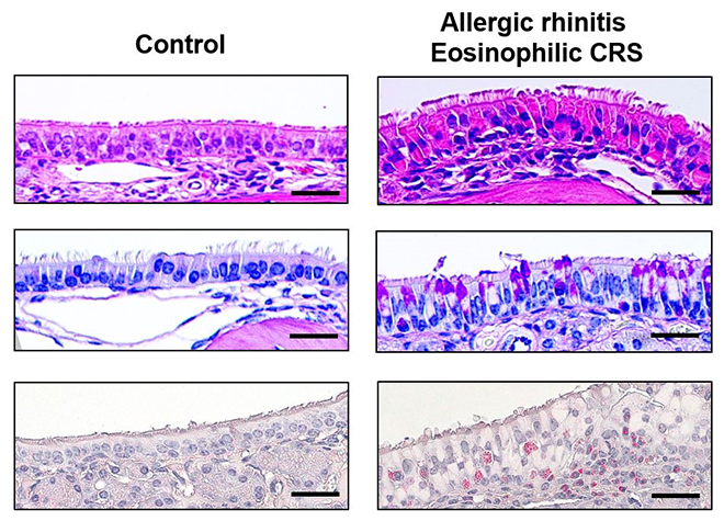 유소아와 성인의 이관 비교 그림