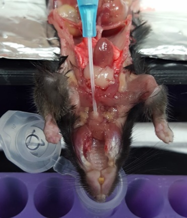 유소아와 성인의 이관 비교 그림